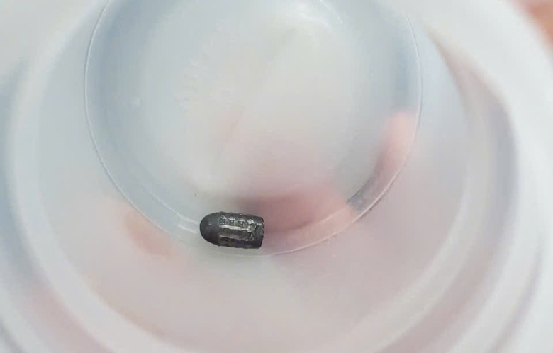 Người phụ nữ Cần Thơ bị vi&ecirc;n đạn lạc găm v&agrave;o đầu l&uacute;c đi l&agrave;m vườn- Ảnh 2.