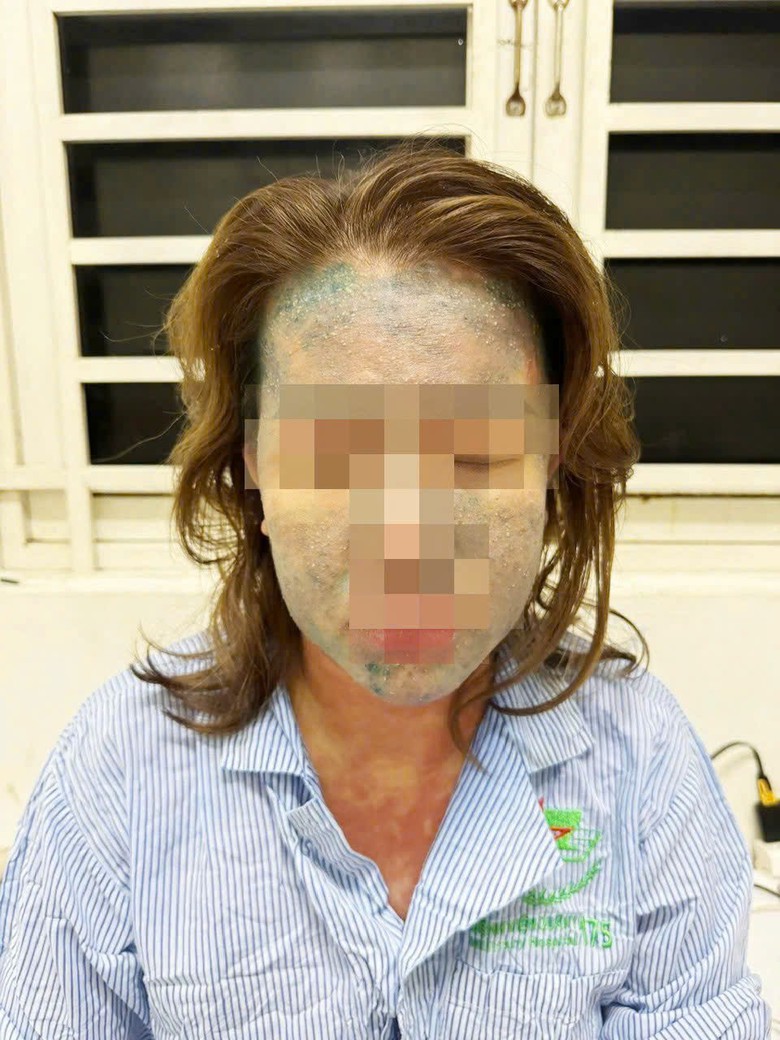 Người phụ nữ nguy kịch sau khi d&ugrave;ng thuốc giảm c&acirc;n thải độc, collagen kh&ocirc;ng r&otilde; nguồn gốc- Ảnh 1.