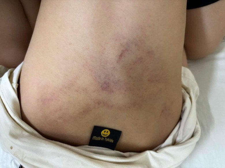 H&agrave; Nội: Tạm đ&igrave;nh chỉ gi&aacute;o vi&ecirc;n trường Mầm non Gia Thụy nghi bạo h&agrave;nh trẻ- Ảnh 1.