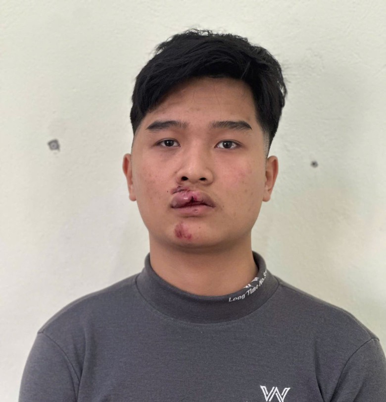 Hưng Yên: Khởi tố thanh niên thông chốt nồng độ cồn, tông trực diện đại úy CSGT- Ảnh 1. Hưng Yên: Khởi tố thanh niên thông chốt nồng độ cồn, tông trực diện đại úy CSGT- Ảnh 1.