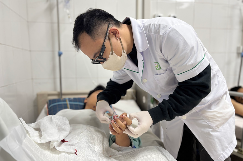 Li&ecirc;n tiếp nhiều ca n&aacute;t tay, bỏng mặt v&igrave; ph&aacute;o nổ- Ảnh 2.