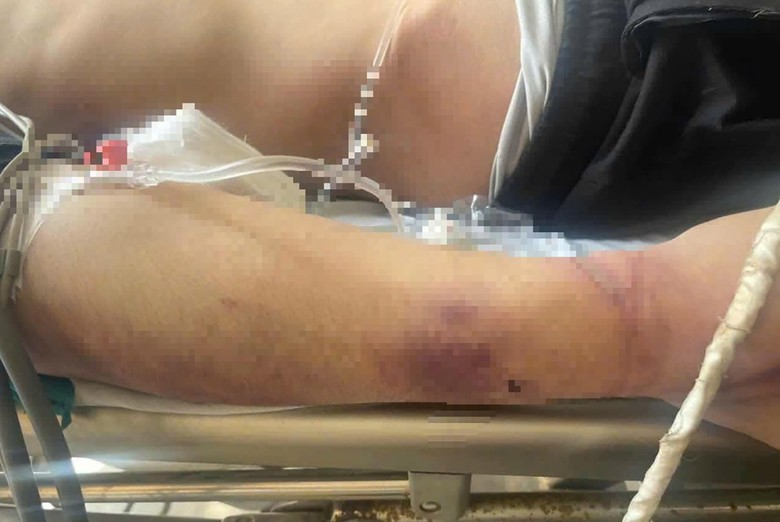 Bộ Y tế y&ecirc;u cầu tổng kiểm tra, chấn chỉnh c&aacute;c cơ sở trợ gi&uacute;p x&atilde; hội- Ảnh 2.