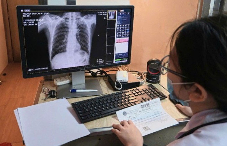 Ph&ograve;ng v&agrave; điều trị sớm để lao kh&ocirc;ng th&agrave;nh g&aacute;nh nặng bệnh tật- Ảnh 1.