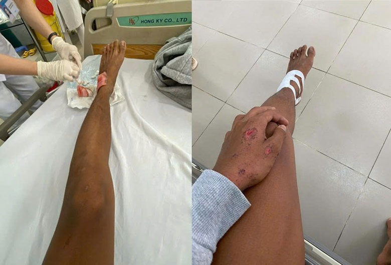 Điều tra vụ hai thiếu ni&ecirc;n bị hơn 10 người đuổi, ch&eacute;m trọng thương ở Cần Giờ- Ảnh 1.