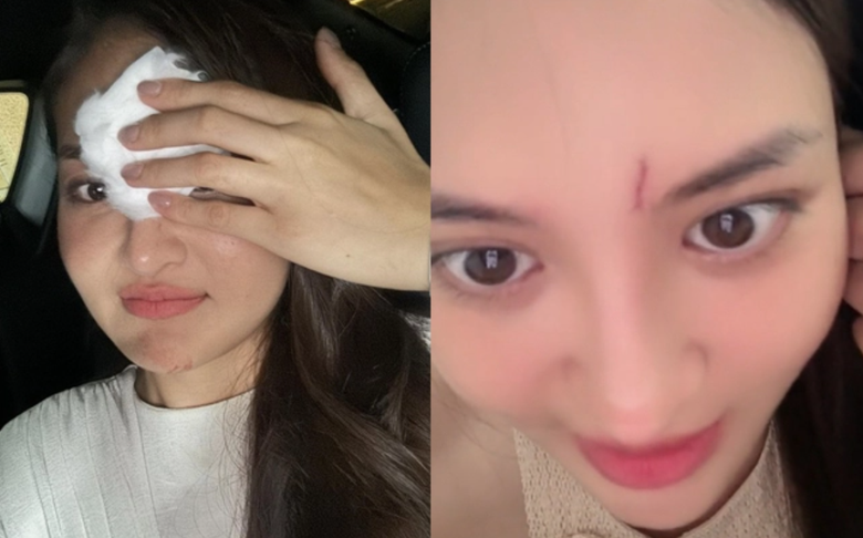 Diễn vi&ecirc;n Th&ugrave;y Anh thắng kiện nh&agrave; sản xuất phim "Bước ngoặt"- Ảnh 2.
