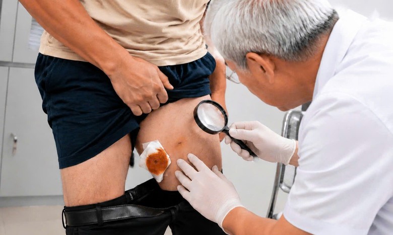 Sau tắm suối nam trung ni&ecirc;n nhiễm ấu tr&ugrave;ng s&aacute;n nh&aacute;i hiếm gặp - Ảnh 1.