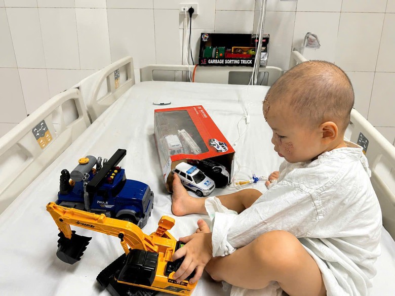 Phục hồi khu&ocirc;n mặt cho b&eacute; trai 26 th&aacute;ng tuổi bị ch&oacute; nh&agrave; cắn n&aacute;t v&ugrave;ng h&agrave;m mặt - Ảnh 3.