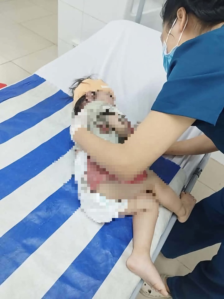 Vụ tai nạn 3 người tử vong ở Cổng 11: Nạn nhân 2 tuổi đã qua cơn nguy kịch- Ảnh 2.