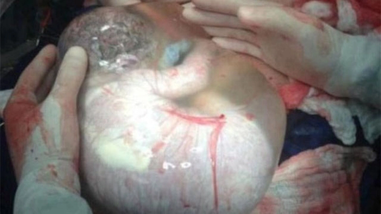 tre-sinh-boc-dieu-1-BIA