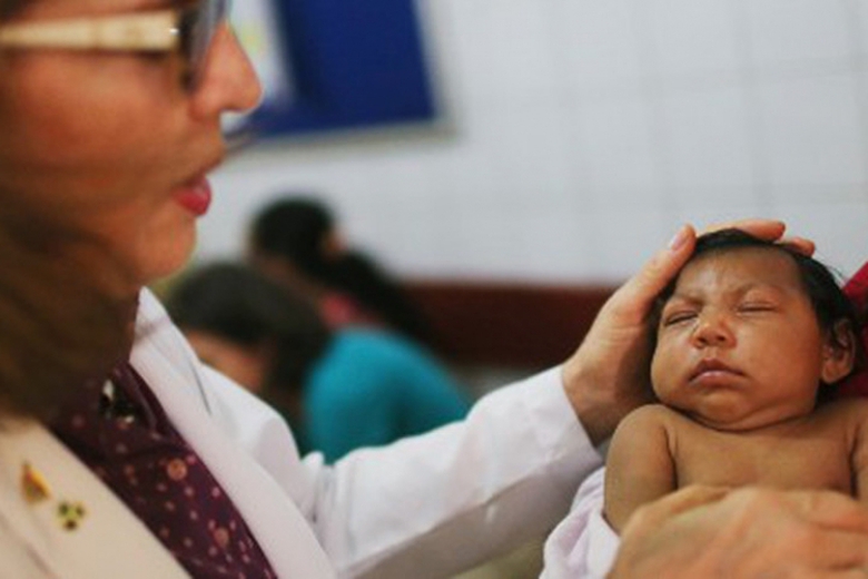 1Virus Zika g&acirc;y ra dị tật đầu nhỏ đối với trẻ sơ s