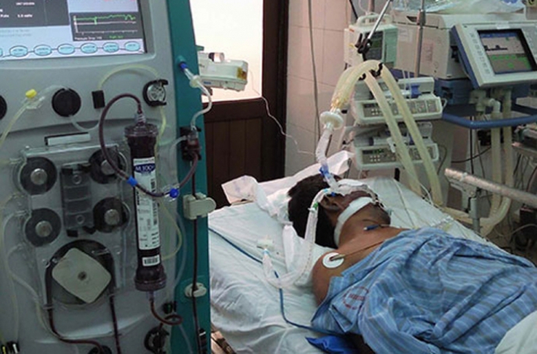 phong-benh-viem-nao-mo-cau