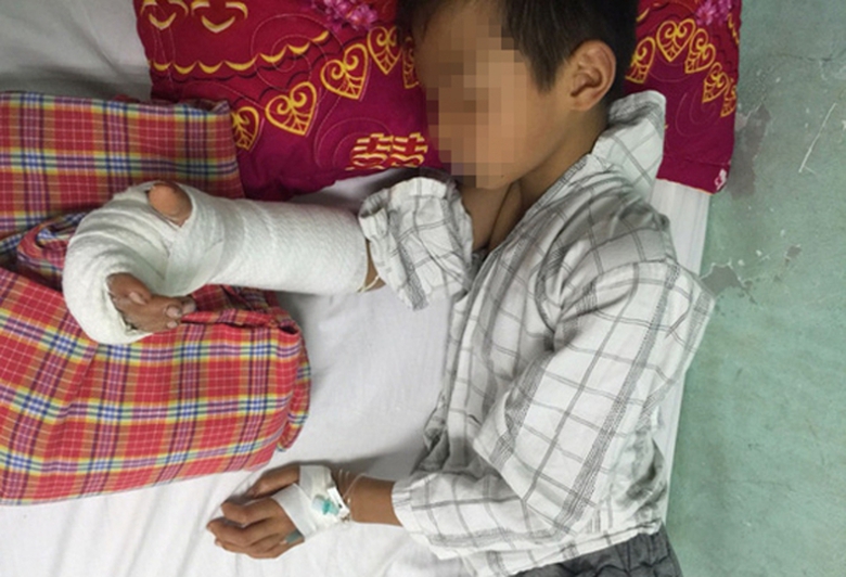 chem-lia-tay-em-trai