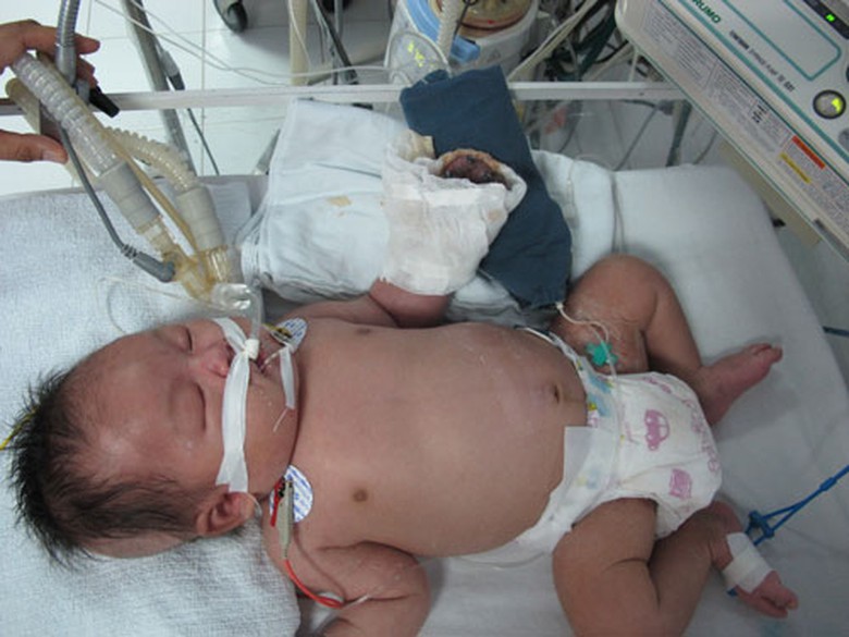 B&eacute; Minh tại bệnh viện Nhi trung ương 