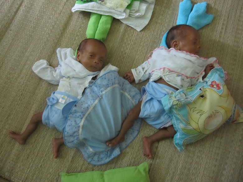 Hai b&eacute; Tuấn T&agrave;i bị suy dinh dưỡng nặng