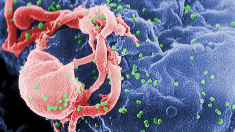  H&igrave;nh ảnh HIV sống trong tế b&agrave;o bạch huyết qua k&iacute;nh hiển vi điện tử - Ảnh Fox News
