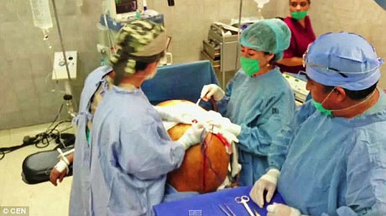 Cận cảnh phẫu thuật cắt bỏ khối u cho b&agrave; Mercedes. 