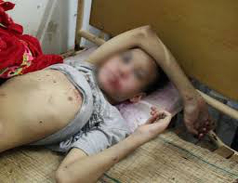 B&eacute; trai 14 tuổi bị bỏ lại trong kh&aacute;ch sạn với nhiều thương t&iacute;ch