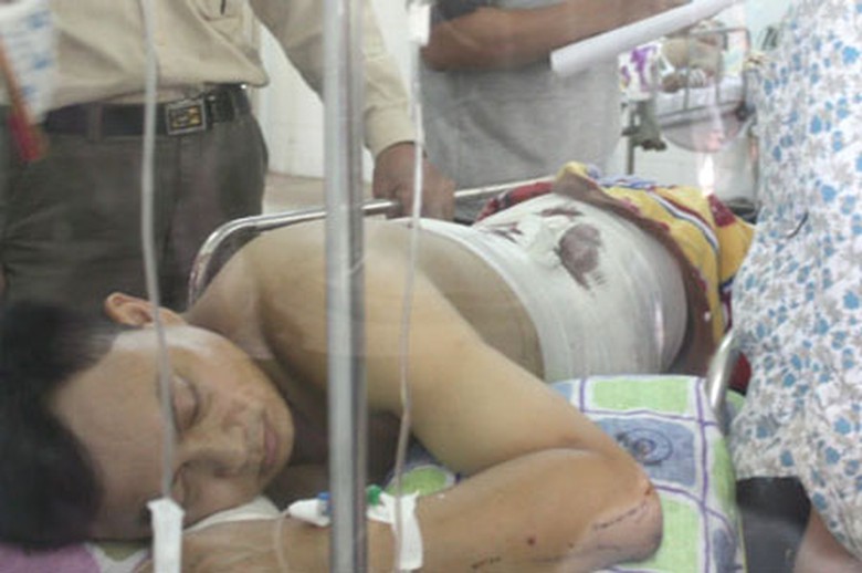 Nạn nh&acirc;n vụ nổ tr&ecirc;n xe kh&aacute;ch giường nằm đang được điều trị tại Bệnh viện đa khoa Hữu nghị Nghệ An