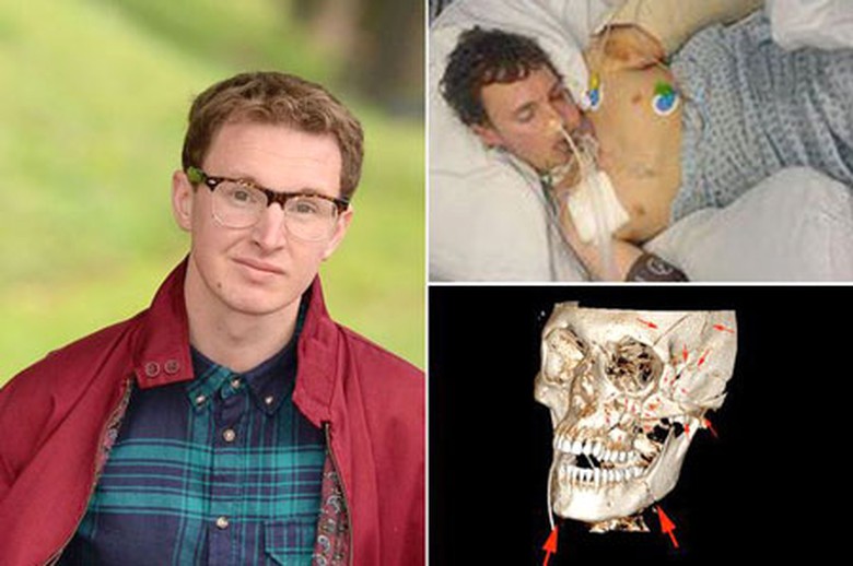 Jack Martindale v&agrave; h&igrave;nh ảnh chấn thương n&atilde;o nghi&ecirc;m trọng do TNGT