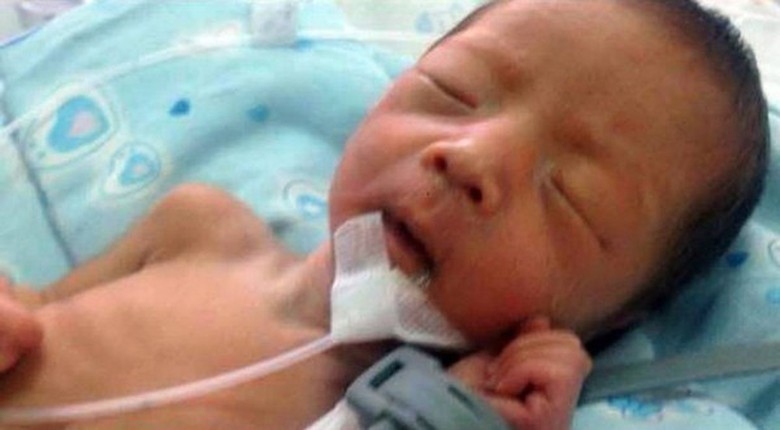 Đứa b&eacute; sống s&oacute;t kỳ diệu d&ugrave; bị ch&ocirc;n sống