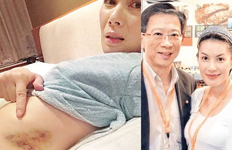 Hy Văn cho biết &ocirc;ng chồng c&ocirc; bản t&iacute;nh rất gia trưởng. 