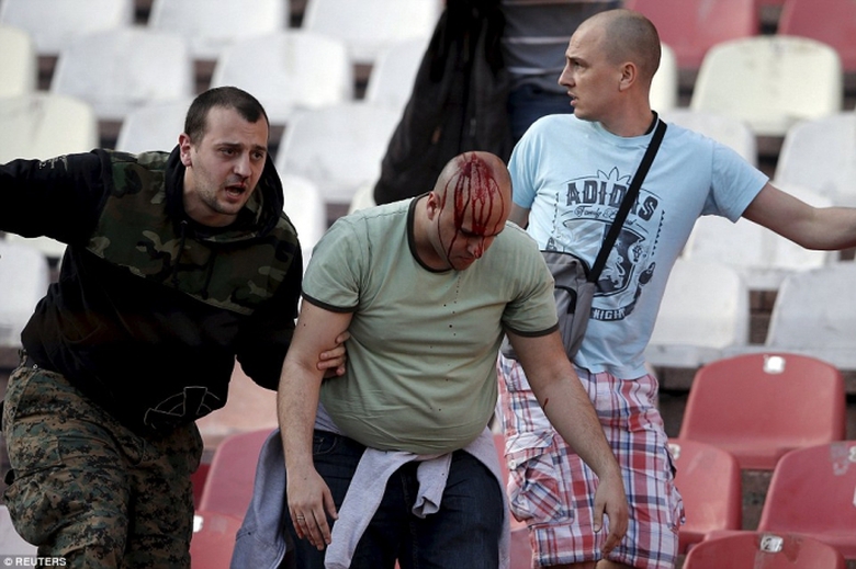 28001E6100000578-3055654-image-a-79_1430002921057