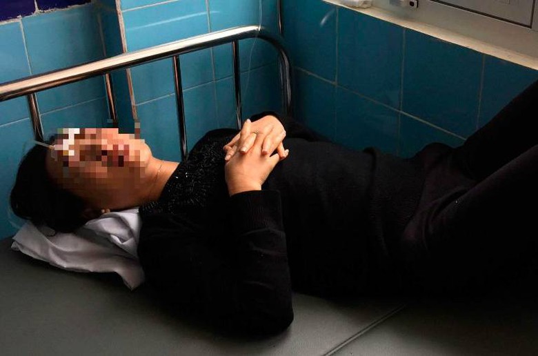 vu-tat-axit-vao-mat-con-dau-me-chong-da-tu-vong