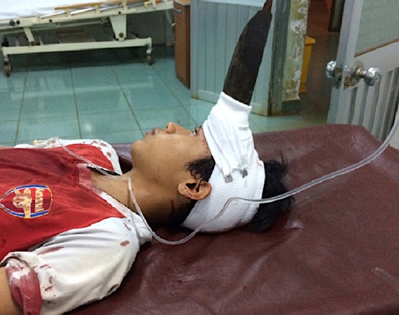 hinh-1-1499924492695