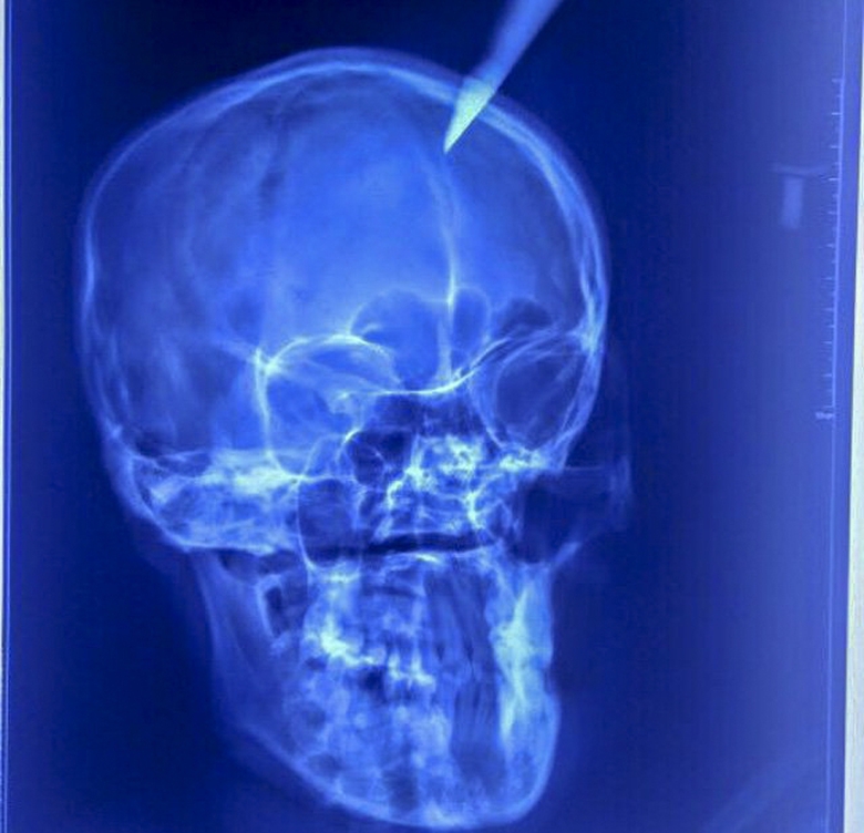 thai phụ bị dao đ&acirc;m 1