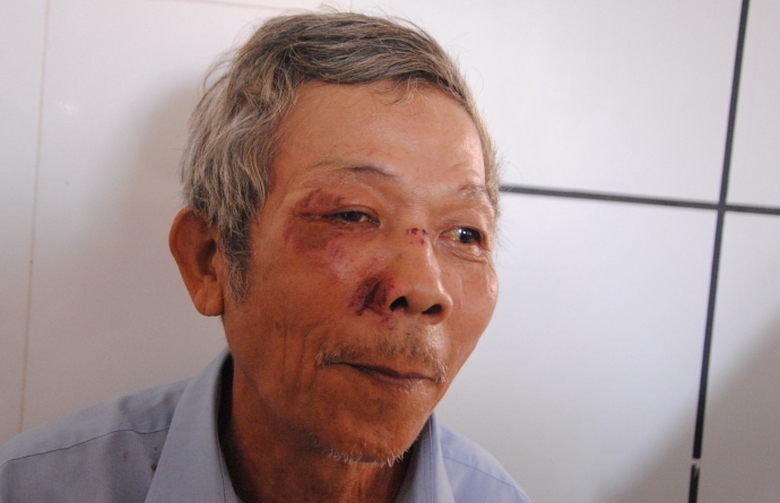 Can- bo- phuong- bo- di- sau- khi- xo- xat- khien-