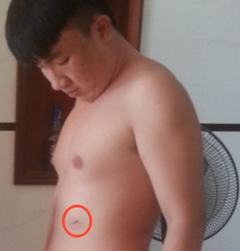 Vet-thuong-con-ong-Ut_1