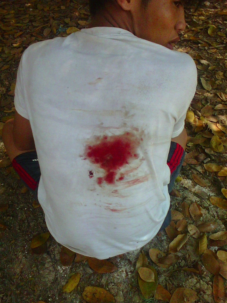 T&ecirc;n Nam đ&aacute; g&agrave; bị bắn trọng thương ở lưng