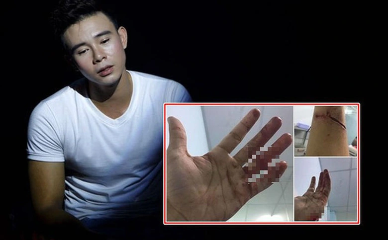 dong hung bi chu no chem