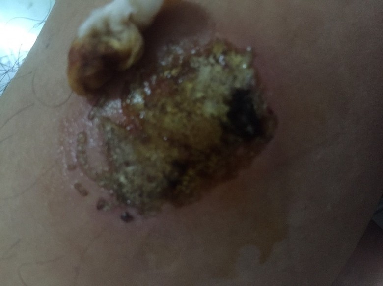 vết thương &ocirc;ng Khanh