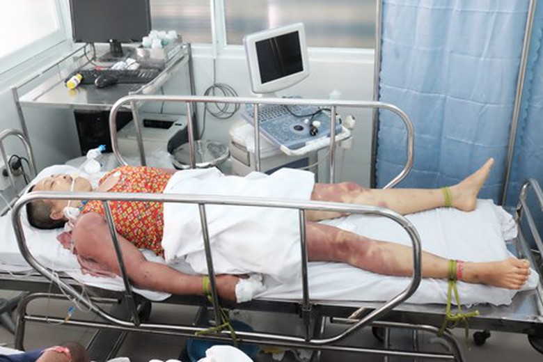 nghi-co-ta-2-chi-em-bi-thay-cung-danh-nguy-kich-hi