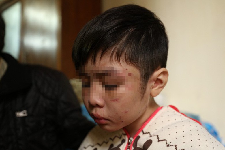 photo-1-1512634126822-155408