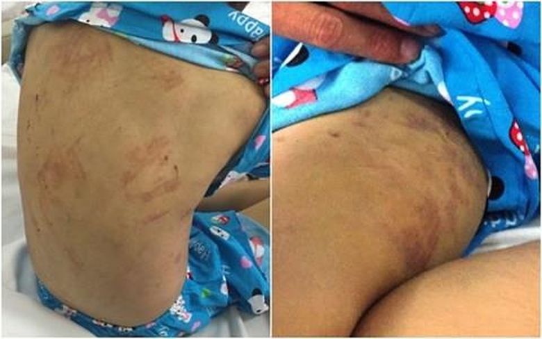 me-ke-danh-con-chongbam-dap-vi-xai-them-1000-dong-