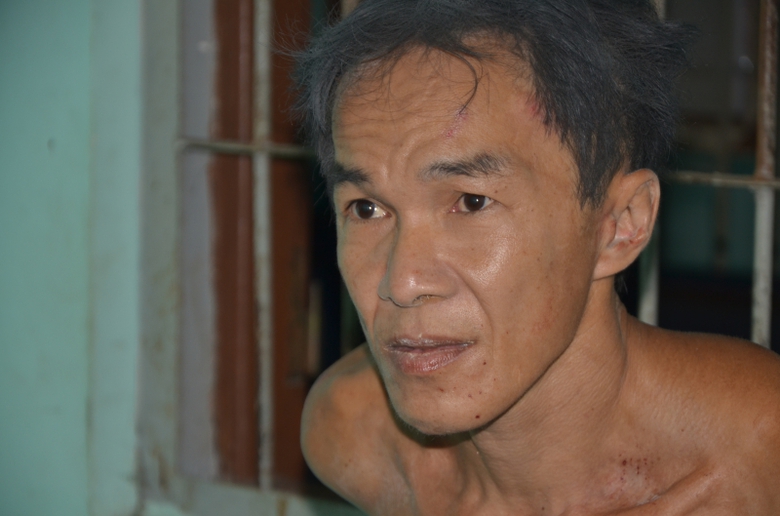 Kẻ giết người, cắt đầu nạn nh&acirc;n mắc bệnh t&acirc;m thần-