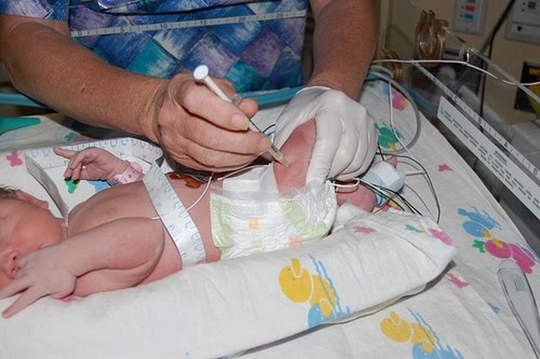 Một trẻ sơ sinh tử vong bất thường sau khi ti&ecirc;m Vi