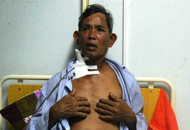 201552-b92b8c25d3633a3d6372