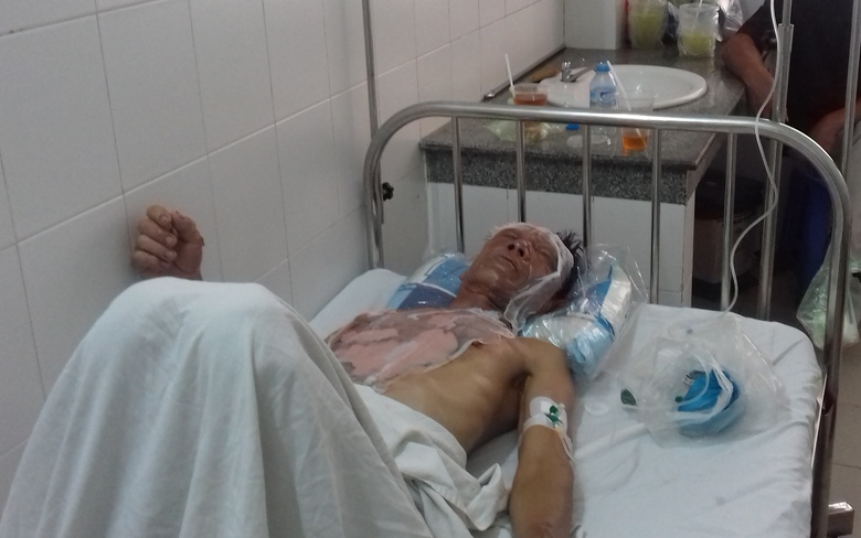 nhan-vien-phuc-vu-dam-cuoi-bat-can-lam-11-nguoi-bi