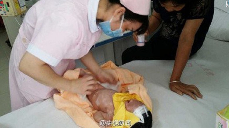 Ch&aacute;u bị chỉ nặng 2,7 kg sau 10 ng&agrave;y bị bỏ rơi