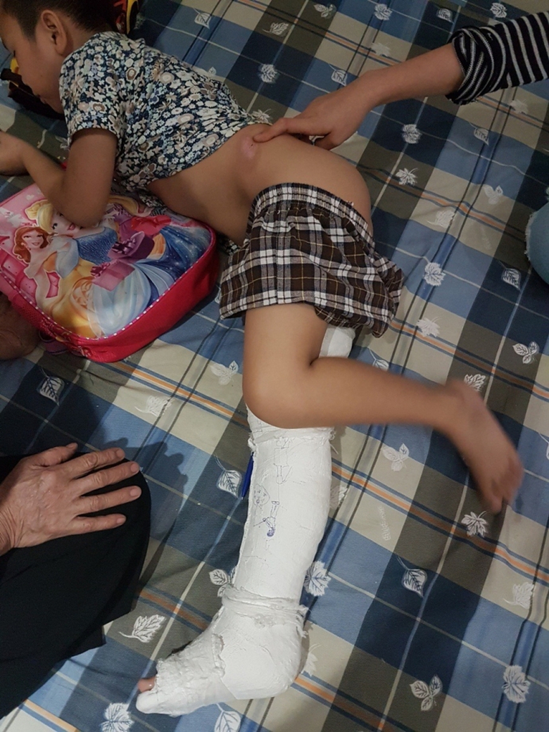 hoc-sinh-gay-xuong-dui