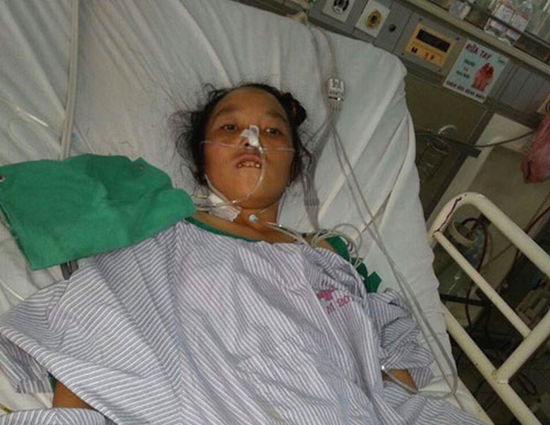 ap-xe-gan-gin-chui-ong-mat