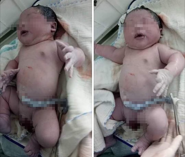 b&eacute; trai hơn 7kg