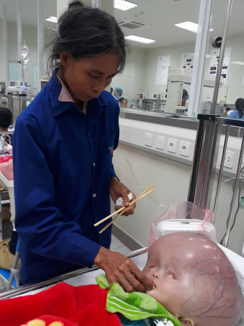 b&eacute; mắc n&atilde;o &uacute;ng thủy