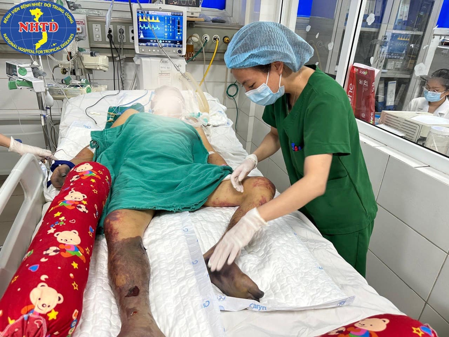 Người đàn ông thích ăn nem chạo, thịt lợn sống nguy kịch vì nhiễm khuẩn liên cầu lợn
- Ảnh 1. Người đàn ông thích ăn nem chạo, thịt lợn sống nguy kịch vì nhiễm khuẩn liên cầu lợn
- Ảnh 1.