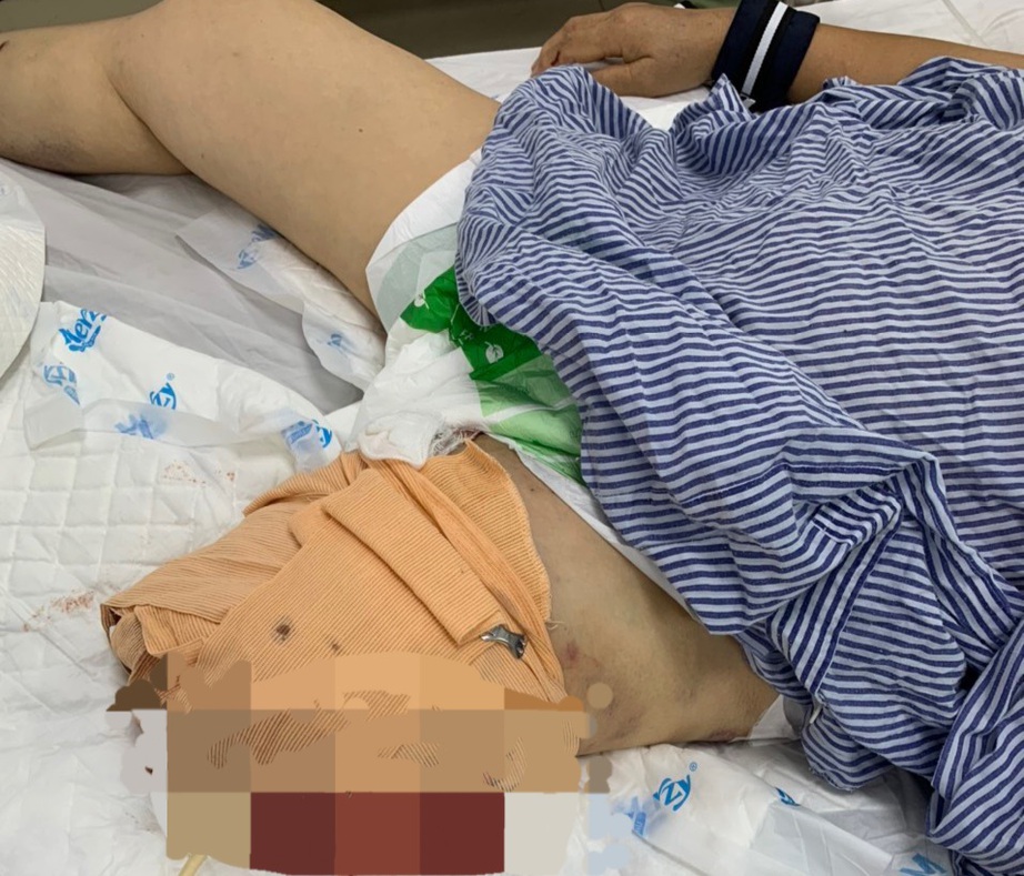 Sức khỏe nạn nh&acirc;n vụ tai nạn tại Đồ Sơn giờ ra sao? - Ảnh 2.