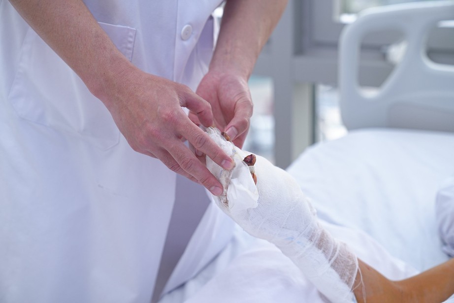 Nam sinh 12 tuổi n&aacute;t b&agrave;n tay v&igrave; chế ph&aacute;o- Ảnh 1.