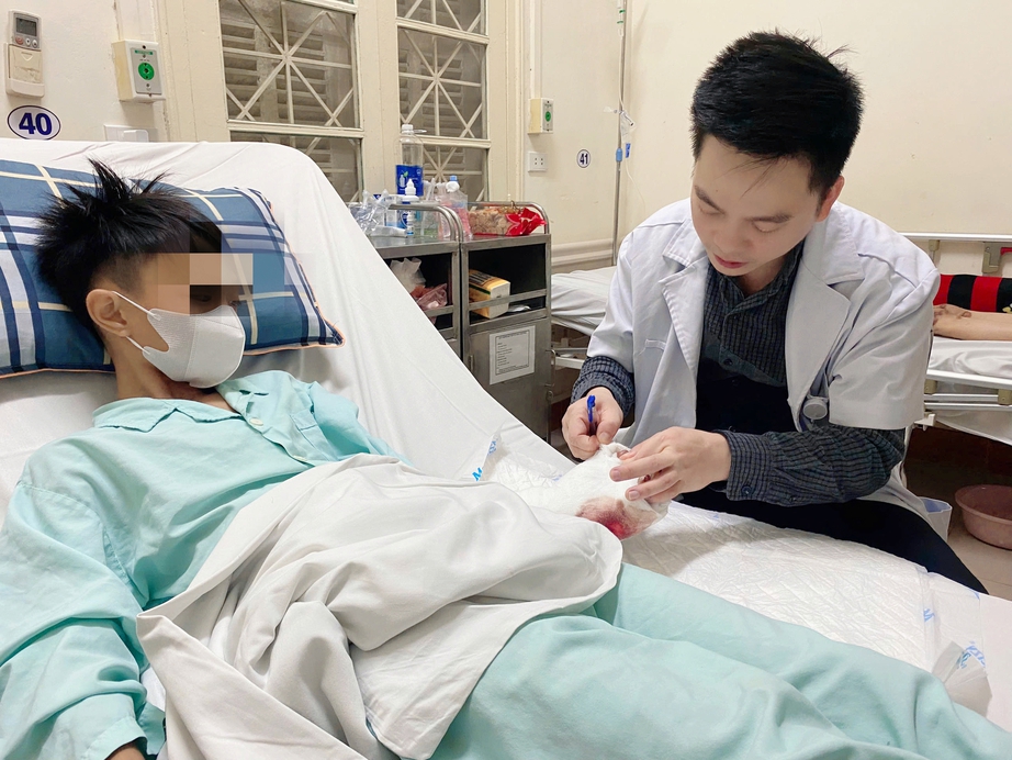 Li&ecirc;n tiếp trường hợp thiếu ni&ecirc;n dập n&aacute;t tay, ch&acirc;n nhập viện cấp cứu do ph&aacute;o tự chế- Ảnh 1.